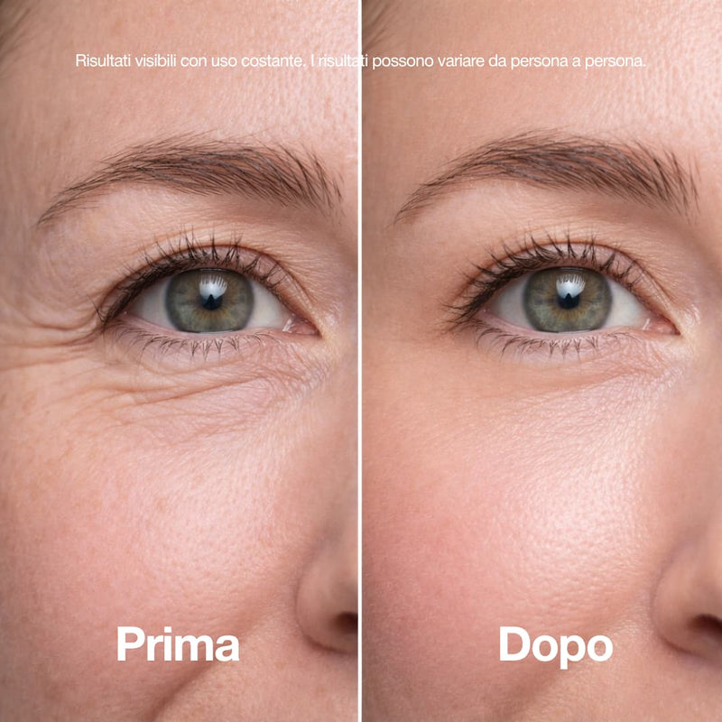 Stick Lifting al Collagene Rosa e PDRN