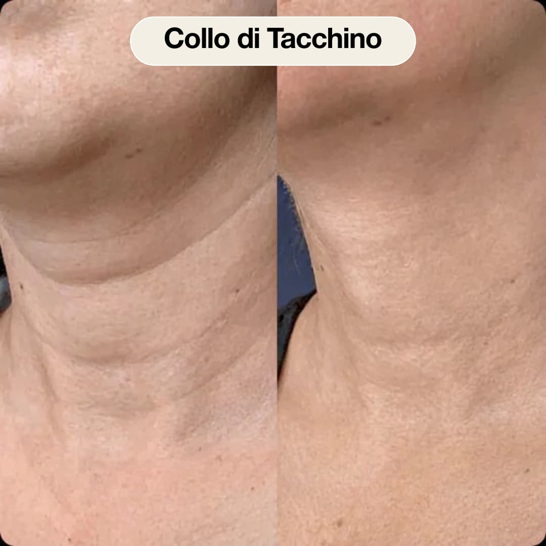 Stick Anti-Età al Calcio e Collagene