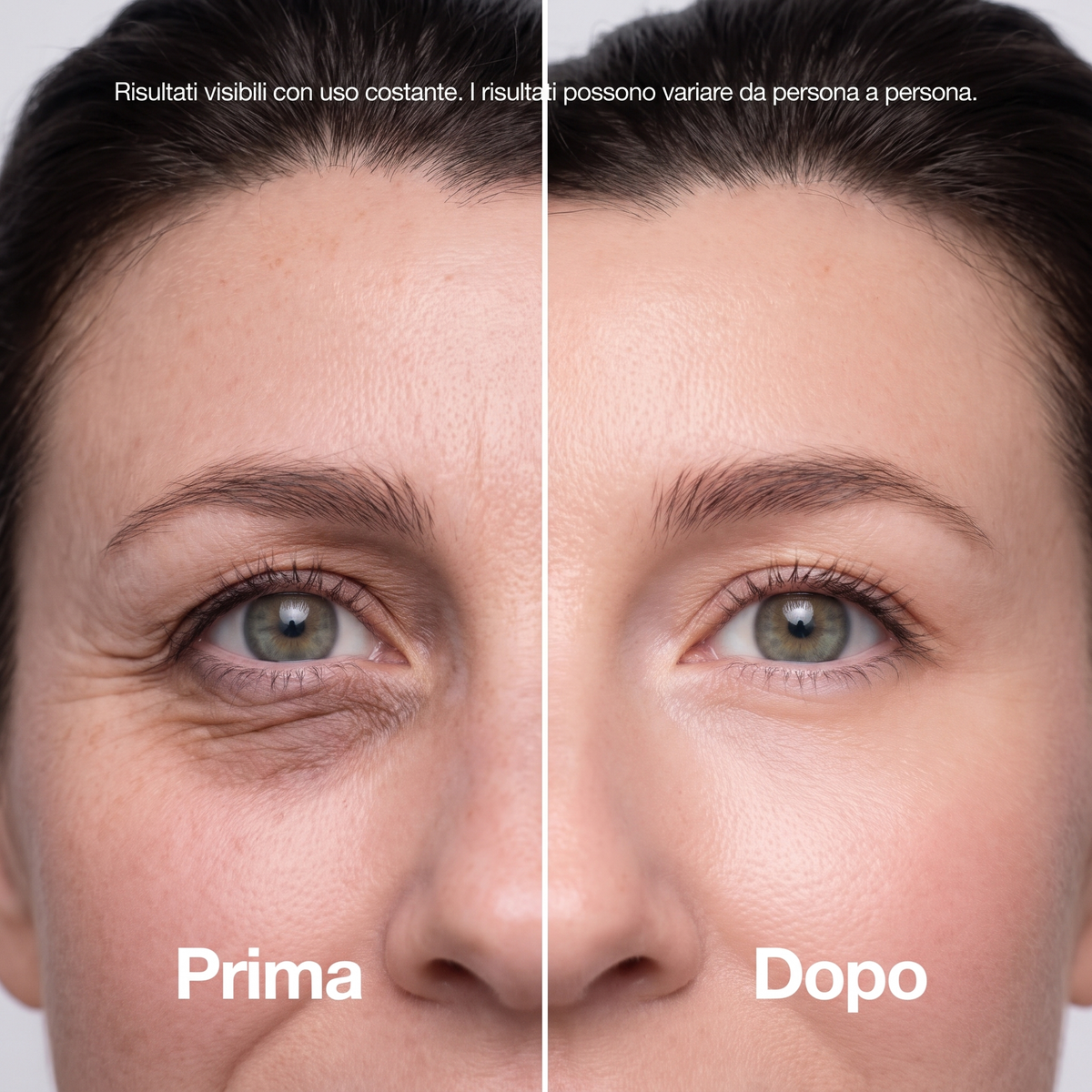 Prima e dopo dello sguardo: occhiaie e linee sottili